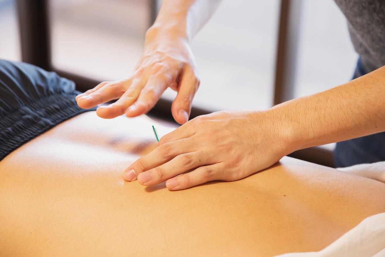 Acupuncture – Traditional and Modern
